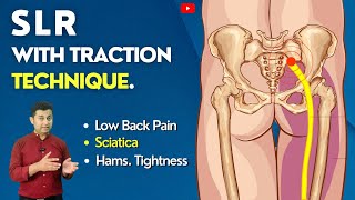 SLR WITH TRACTION TECHNIQUE  GET RELIEF IN SCIATICA SYMPTOMS  BACK  LEG PAIN [upl. by Justinian]