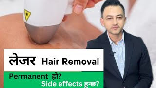 Laser Hair Removal in Nepal  Price Sessions Side effects and more [upl. by Huskey]