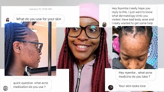 MY ACNE JOURNEYHOW I FINALLY CLEARED MY SKIN  Nyemba [upl. by Nitsur273]