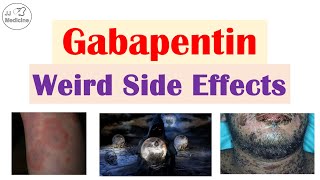 Gabapentin Weird Side Effects Skin Psychological Eyes [upl. by Jessika782]