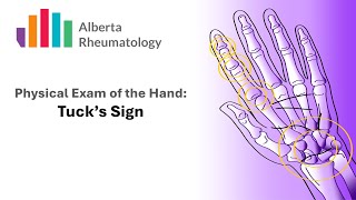 Rheumatology HAND exam Tuck Sign for Extensor Tenosynovitis [upl. by Ahseele]