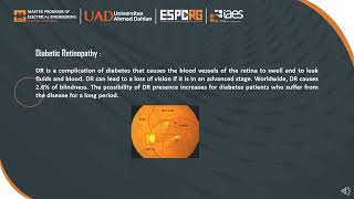 Identification of Ocular Disease from fundus images using CNNwith Transfer Learning [upl. by Lynden864]