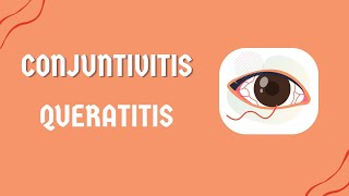 CONJUNTIVITIS  QUERATITIS  2024  II  USMP [upl. by Adi572]