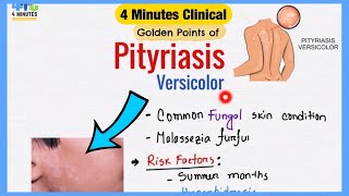 Pityriasis Versicolor Explained Like Water  Symptoms Pathogenesis Treatment  4 Minutes Clinical [upl. by Retsevel]