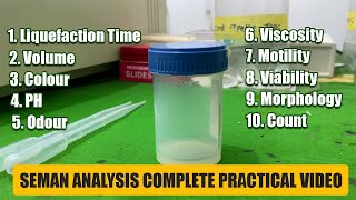 Semen Analysis Test Lab  Complete Practical Video  Medilablife [upl. by Schaper]