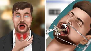 ASMR Animation Remove fish bones stuck in MrBeasts throat [upl. by Thibault]