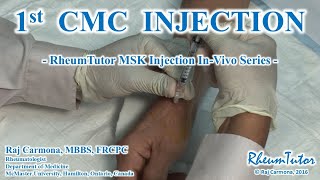 1st CMC INJECTION  InVivo Series [upl. by Seyer]