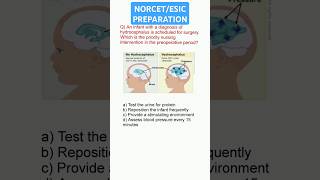 Hydrocephalus mcqs nursingmcq paediatrics cation medicalstudentquiz [upl. by Noryv]