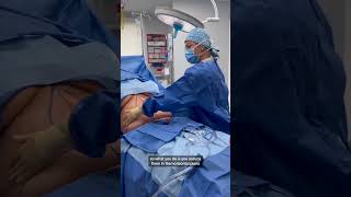 Fleurdelis Abdominoplasty womansurgeon tummytucksurgery [upl. by Eltsyek]