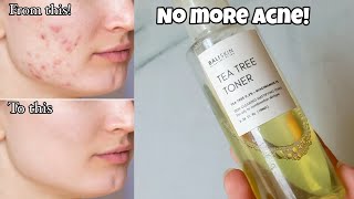 Bali Skin Tea Tree Toner  Honest Review  Best for Acne [upl. by Asirrak]