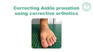 Correcting Ankle pronation using corrective orthotics [upl. by Quinton]