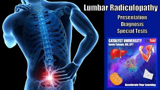 Lumbar Radiculopathies  Presentation Diagnosis amp Special Tests [upl. by Auos443]