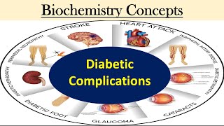 Diabetic Complications pkprabhakar clinicalbiochemistry [upl. by Ludovico]