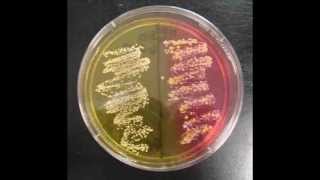 How to Interpret Mannitol Salt Agar Bacterial Growth Medium [upl. by Ki831]