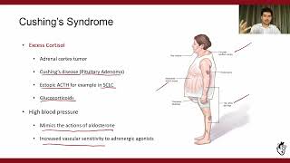 Secondary Hypertension Part 23 Endocrine Causes [upl. by Demeter]