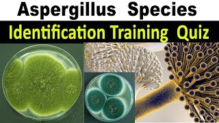 Aspergillus Species Identification Training Quiz [upl. by Malvin]