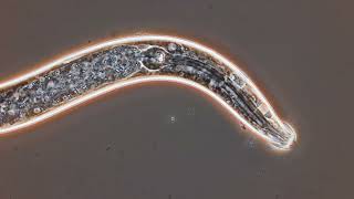 Soil nematodes in phase contrast Acrobeles and Wilsonema [upl. by Laurette650]