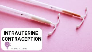 Intrauterine Contraception [upl. by Notled]