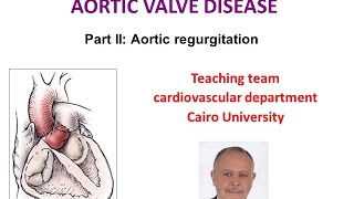 Aortic regurgitation lecture [upl. by Collar]