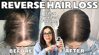 How I STOPPED MY HAIR LOSS  1 Thing That ReGrew My Hair [upl. by Apilef197]