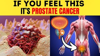 Prostate Cancer 10 Early Signs and Symptoms Don’t Ignore [upl. by Cutter]