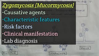 Zygomycosis Mucormycosis  Agents  Risk factors  Clinical manifestation  Lab diagnosis [upl. by Aisatna808]