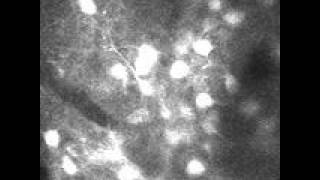 Firing Neurons in Mouse Visual Cortex [upl. by Notned824]