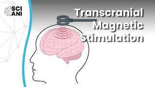 What is Transcranial Magnetic Stimulation and how can it help me [upl. by Linad]