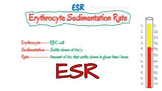 what is esr blood test  Different method  factor affecting ESR [upl. by Ravi]