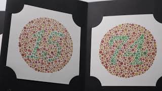 Ishihara Test in Action A RealTime Colorblindness Test [upl. by Deach]