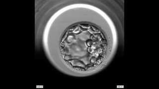 EmbryoScope Embryo Development  Blastocyst [upl. by Delle]