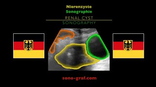 Sonographie  Nierenzyste [upl. by Obola]