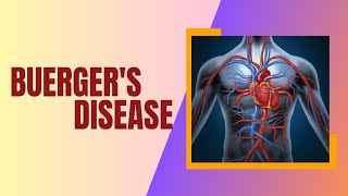 Buerger disease Thromboangiitis obliterans [upl. by Esdnil106]