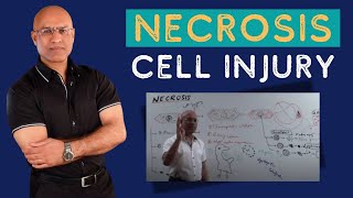 Necrosis Cell Injury  Apoptosis  General Pathology🦠 [upl. by Llesram]