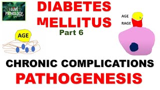 DIABETES MELLITUS  Part 6 Chronic Complications Pathogenesis [upl. by Akiehs]