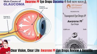 STOP Wasting Money on Ineffective Eye Drops Try AWARENEPF Instead [upl. by Anehsat]