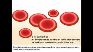 Bloedarmoede  Wat is bloedarmoede en wat zijn de symptomen [upl. by Yelhak696]