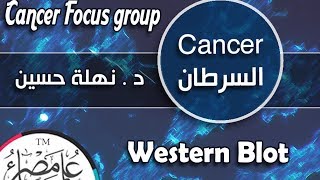 ُ ESCancer Focus Group  Western Blot [upl. by Nowed143]