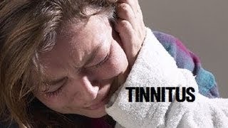 My Tinnitus amp Hearing Loss Struggle Sensorineural Hearing Loss Vlog 1 [upl. by Barcus770]