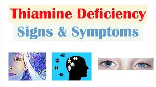 Thiamine Vit B1 Deficiency Signs amp Symptoms amp Why They Occur [upl. by Jacklin]