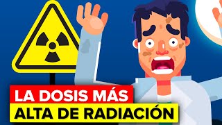 Hombre recibe la dosis más alta de radiación nuclear  Esto es lo que le pasó [upl. by Jerri]