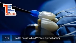 Two lifehacks to hold Veneers during bonding Episode 16 [upl. by Yehudit]