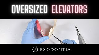 Another Approach To Elevating Teeth  OnlineExodontiacom [upl. by Epstein752]