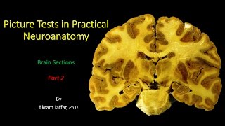 Picture Test in Neuroanatomy Brain Sections 2 [upl. by Yrrah]