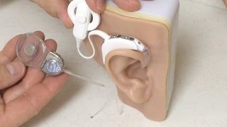 Sound Science Hybrid Cochlear Implants [upl. by Ttoille]