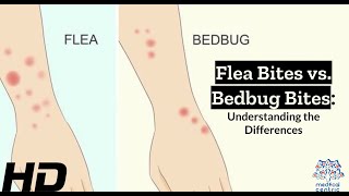 Bug Bite Showdown Identifying Flea vs Bedbug Bites [upl. by Mavis]