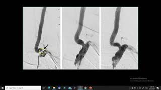 Anatomy of the Vertebral artery [upl. by Rolecnahc]