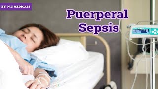 puerperal sepsis part 1 NGMedicals [upl. by Hamachi6]