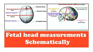 Fetal head measurements [upl. by Muscolo269]