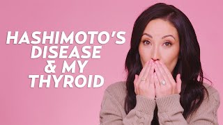 How My Hashimotos Disease Affects My Appearance Hypothyroid Symptoms  Skincare with Susan Yara [upl. by Whallon]